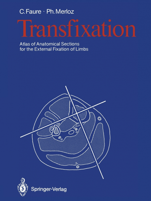 Transfixation