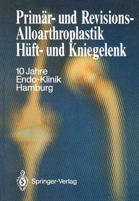 Primär- und Revisions-Alloarthroplastik Hüft- und Kniegelenk