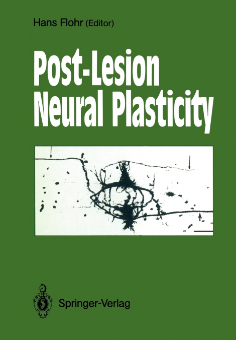 Post-Lesion Neural Plasticity