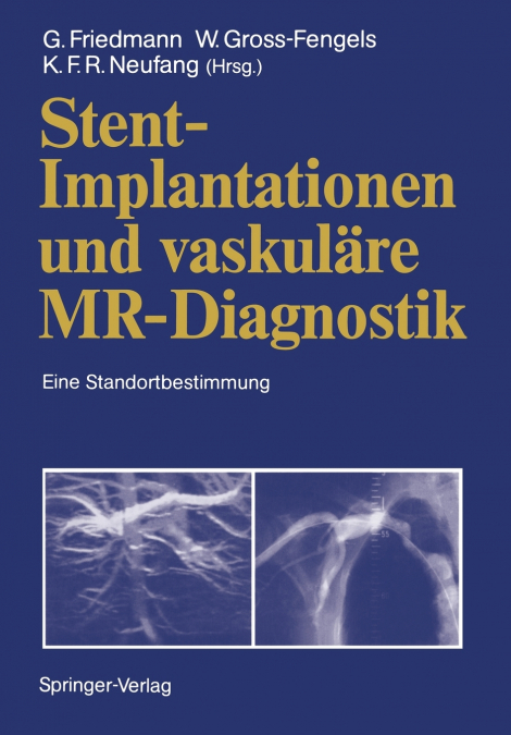 Stent-Implantationen und vaskuläre MR-Diagnostik