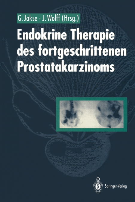 Endokrine Therapie des fortgeschrittenen Prostatakarzinoms
