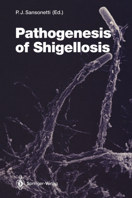 Pathogenesis of Shigellosis