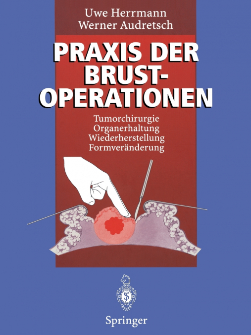 Praxis der Brustoperationen