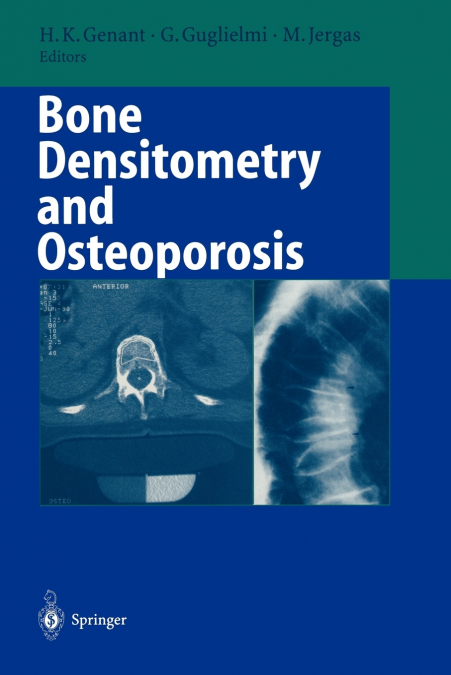 Bone Densitometry and Osteoporosis