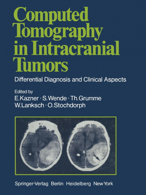 Computed Tomography in Intracranial Tumors