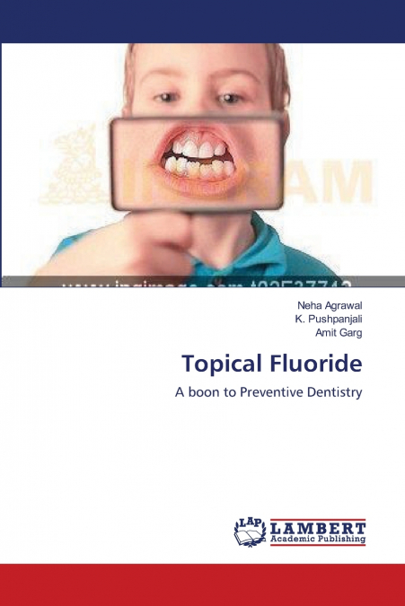 Topical Fluoride