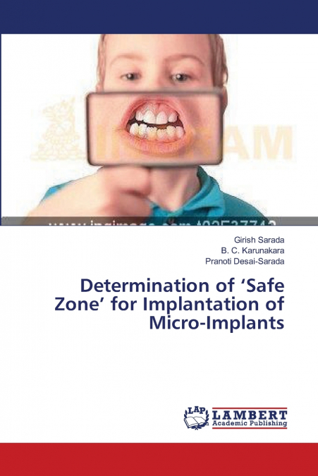 Determination of ’Safe Zone’ for Implantation of Micro-Implants