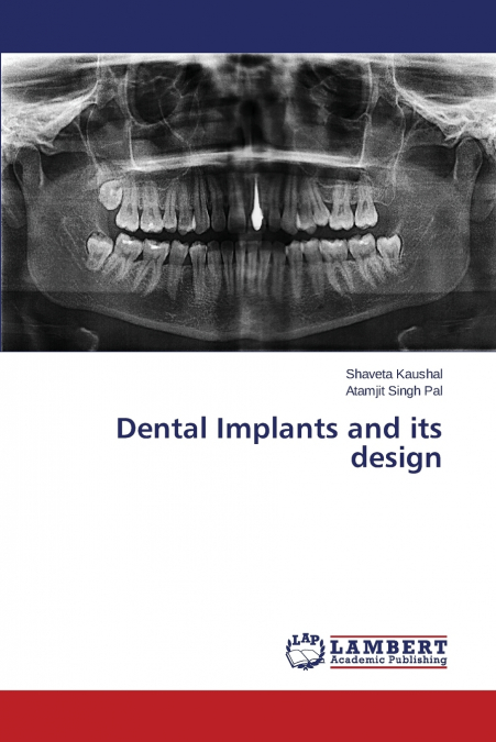 Dental Implants and Its Design