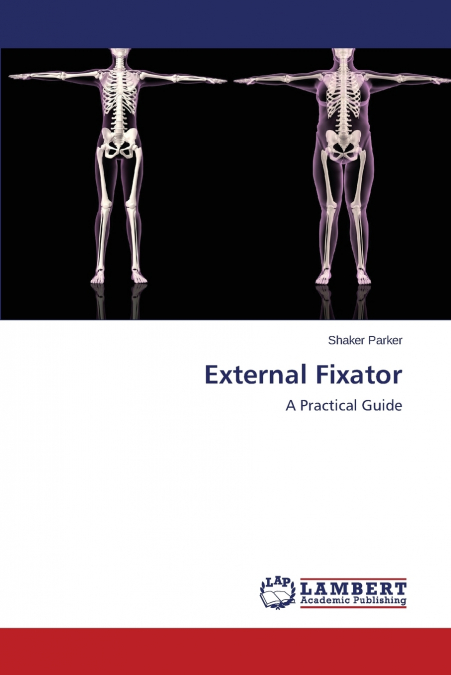 External Fixator