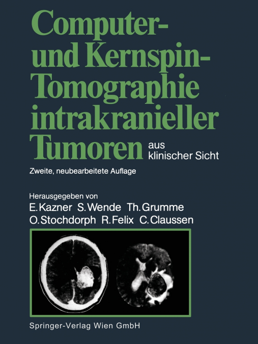 Computer- Und Kernspin-Tomographie Intrakranieller Tumoren Aus Klinischer Sicht