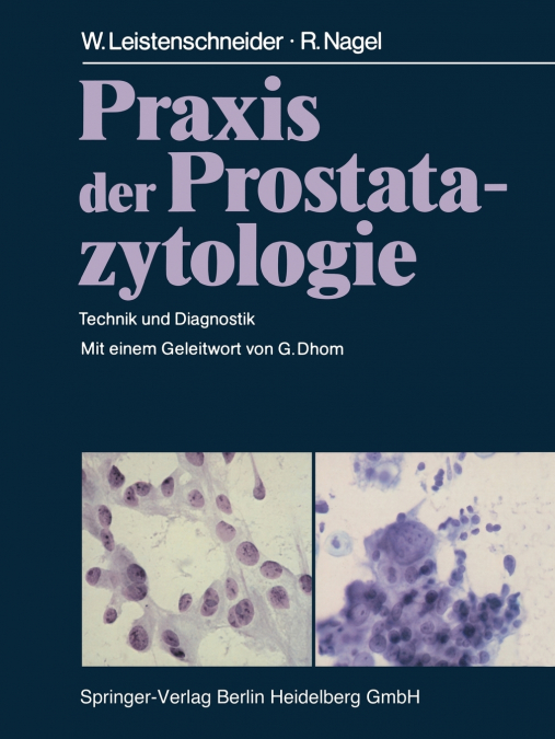 Praxis Der Prostatazytologie