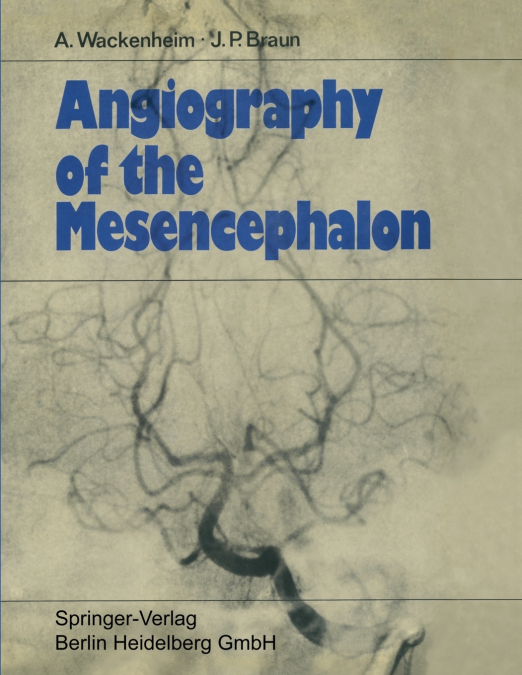 Angiography of the Mesencephalon