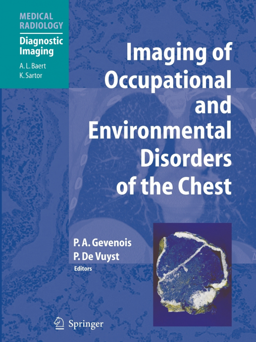 Imaging of Occupational and Environmental Disorders of the Chest