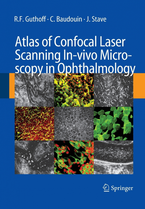 Atlas of Confocal Laser Scanning In-vivo Microscopy in Ophthalmology