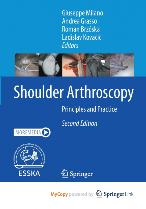 Shoulder Arthroscopy