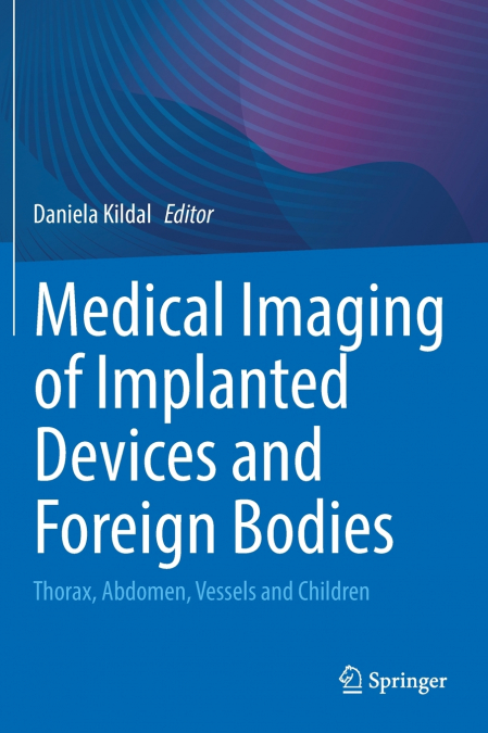 Medical Imaging of Implanted Devices and Foreign Bodies