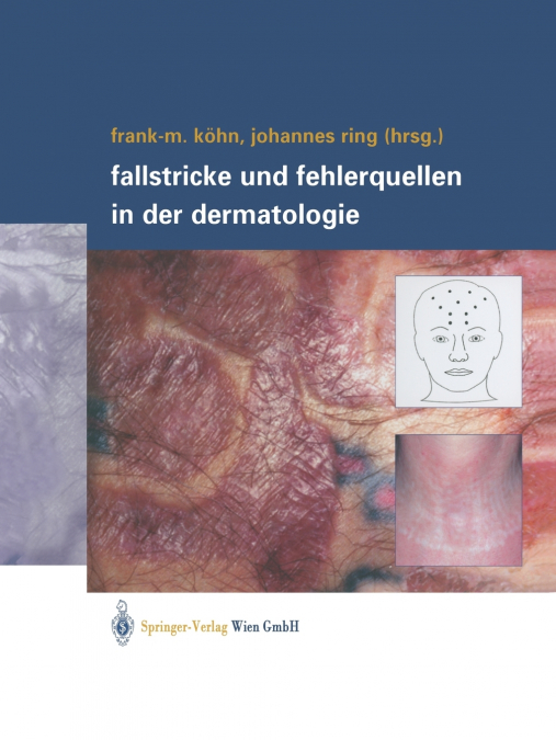 Fallstricke Und Fehlerquellen in Der Dermatologie