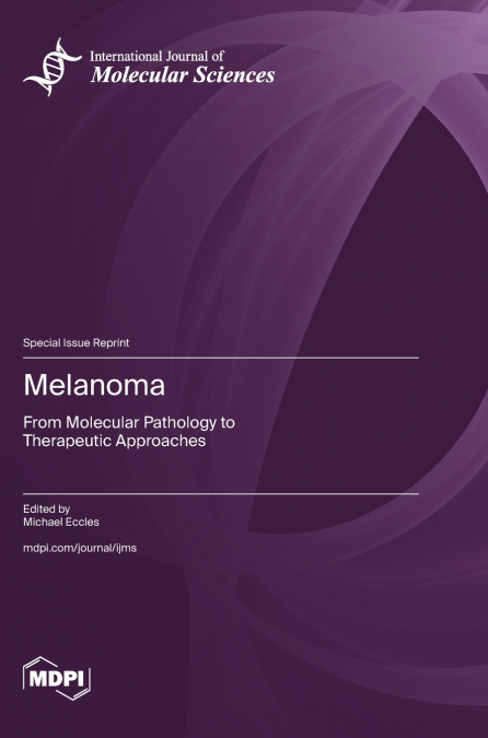 Melanoma