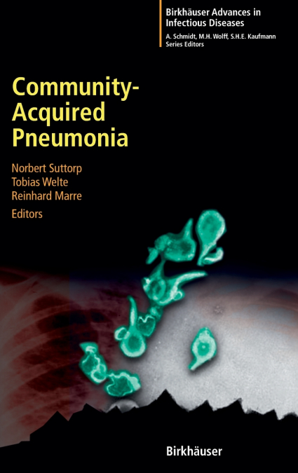 Community-Acquired Pneumonia