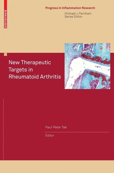 New Therapeutic Targets in Rheumatoid Arthritis