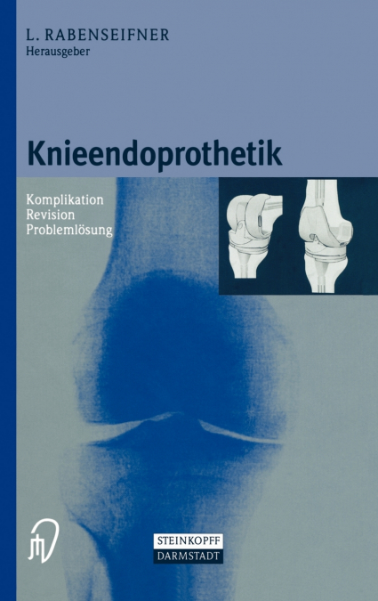 Knieendoprothetik