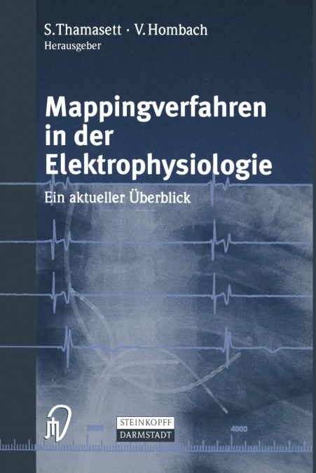 Mappingverfahren in Der Elektrophysiologie