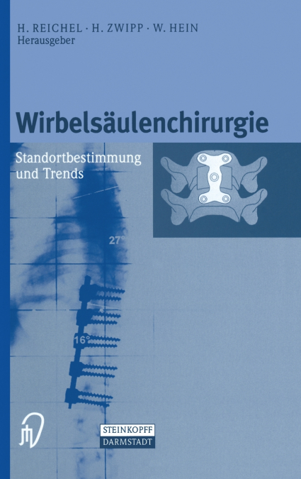 Wirbelsäulenchirurgie