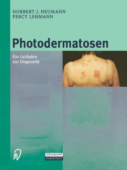 Photodermatosen