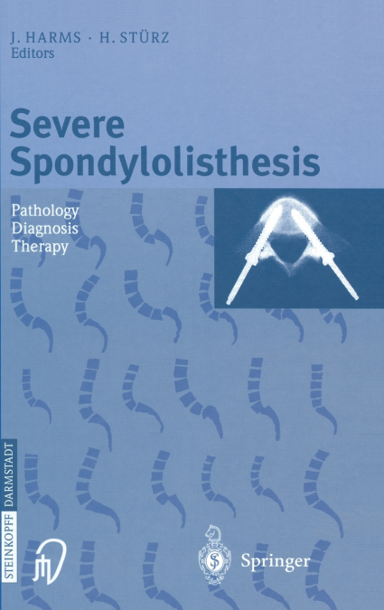 Severe Spondylolisthesis
