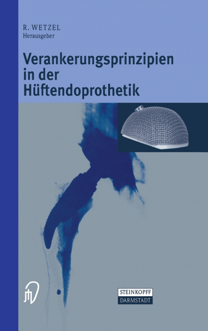 Verankerungsprinzipien in der Hüftendoprothetik