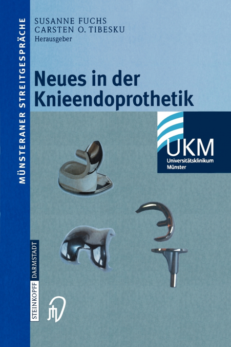 Neues in der Knieendoprothetik