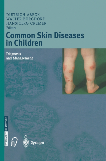 Common Skin Diseases in Children