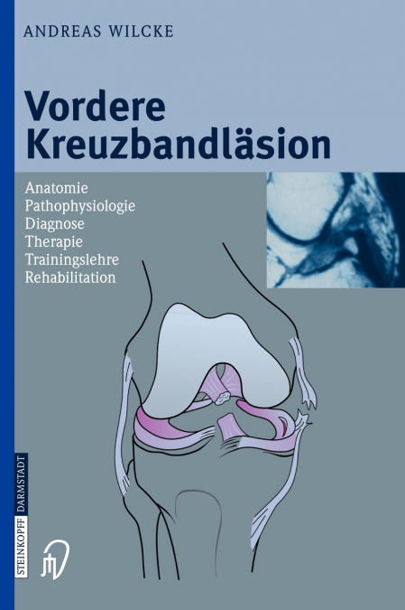 Vordere Kreuzbandlasion