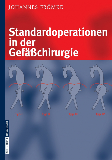 Standardoperationen in der Gefäßchirurgie