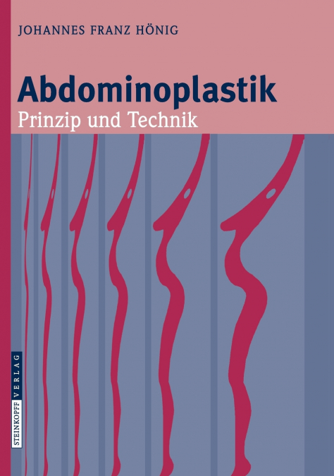 Abdominoplastik