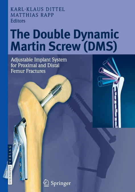 The Double Dynamic Martin Screw (DMS)