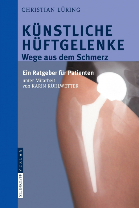 Künstliche Hüftgelenke