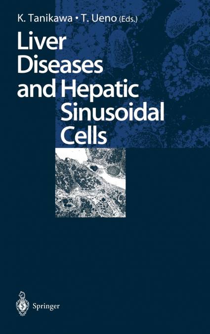 Liver Diseases and Hepatic Sinusoidal Cells