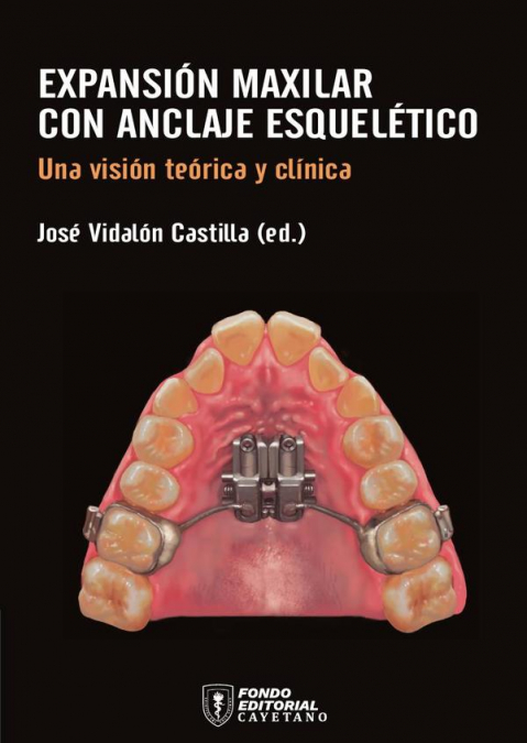 Expansión maxilar con anclaje esquelético