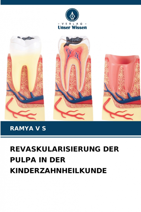 REVASKULARISIERUNG DER PULPA IN DER KINDERZAHNHEILKUNDE