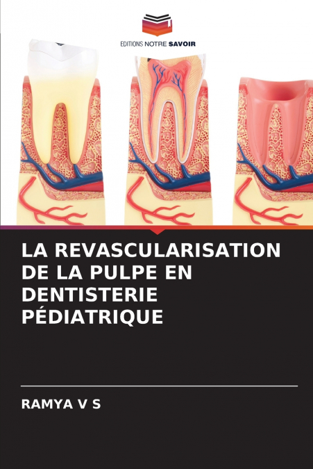 LA REVASCULARISATION DE LA PULPE EN DENTISTERIE PÉDIATRIQUE