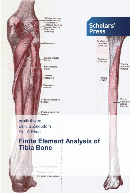 Finite Element Analysis of Tibia Bone