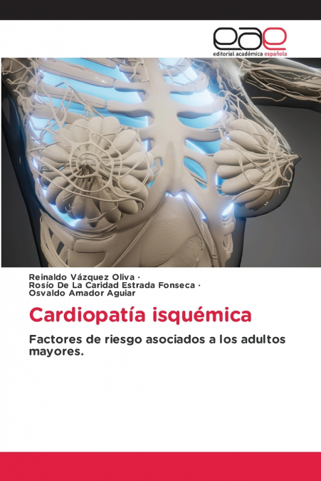 Cardiopatía isquémica