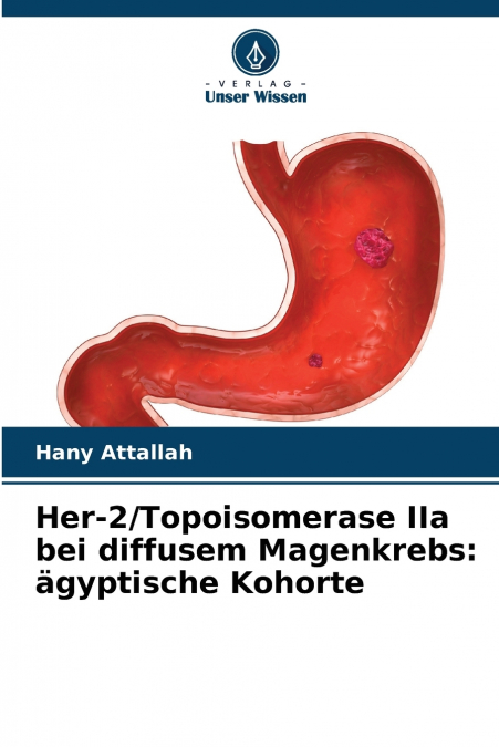Her-2/Topoisomerase IIa bei diffusem Magenkrebs
