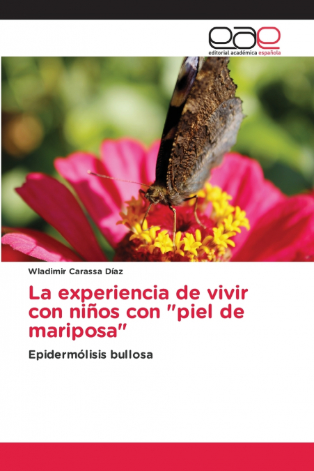 La experiencia de vivir con niños con 'piel de mariposa'