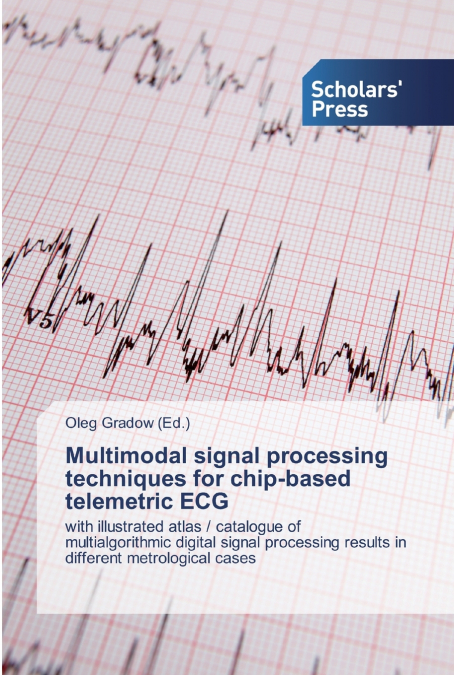 Multimodal signal processing techniques for chip-based telemetric ECG