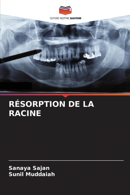 RÉSORPTION DE LA RACINE