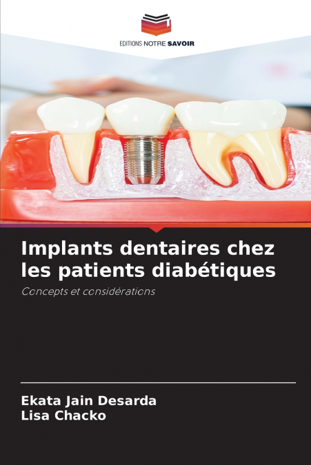 Implants dentaires chez les patients diabétiques