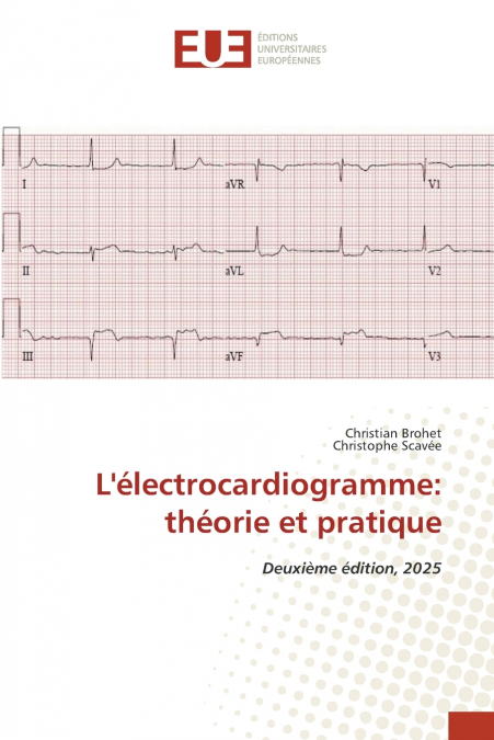 L’électrocardiogramme