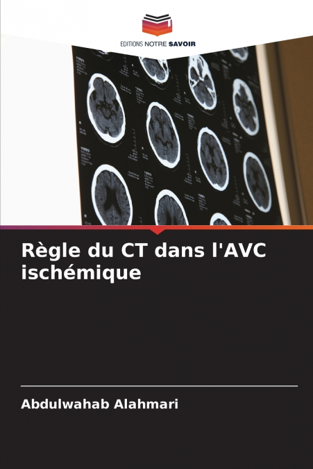 Règle du CT dans l’AVC ischémique